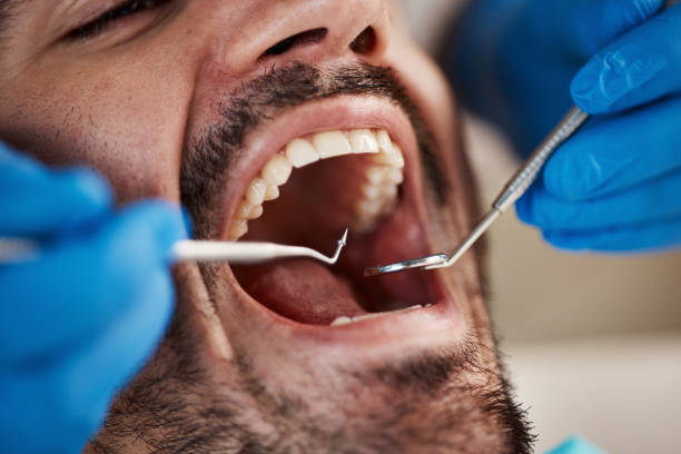 Best Broken or Cracked Tooth Emergency Dentist in Culpeper, VA