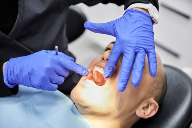 Best Emergency Dentist for Lost Fillings or Crowns in Culpeper, VA